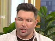 Bobby Norris Spent £50K on Fillers Before Facelift, Wants Gemma Collins Reunion