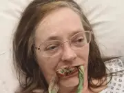 Cancer treatment rots teeth, patient faces £25k implant bill