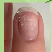 Cleaner-Approved Nail Serum 'Makes a Real Difference' to Damaged Nails