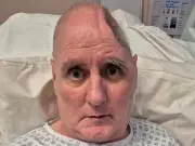 Cyclist Has Quarter of Skull Removed After Hitting Fly-Tipped Shed