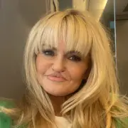 Danniella Westbrook reveals 'no bone' on one side of face amid reconstruction