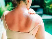 Doctor Warns: Check Sun Cream Expiry Date or Risk Skin Damage