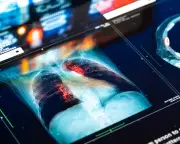 Doctors could face lawsuits over AI tool mistakes, warns report