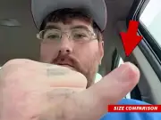 Man with 0.38-inch penis launches fundraiser for enlargement surgery