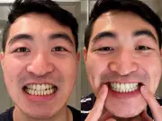 MySweetSmile Bundle: 6p-a-Day Whitener Transforms Teeth in Days