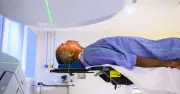 NHS Expands Precision Radiotherapy for Prostate Cancer Patients