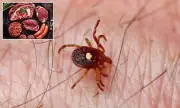 Outrage as Scientists Claim It's Moral to Infect People with Meat Allergy via Ticks