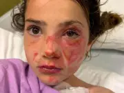 Parents Warned After Toy Leaves Children Hospitalised with Burns