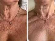 Sagging Neck Cream Slashed from £86 to £32: Women in Their 70s Rave