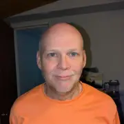 Single Dad Can't Eat Solid Food After Half His Teeth Rotted