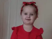 Toddler dies from lice infestation, parents plead guilty to homicide