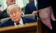Trump's 'Perfect' Health Report Sparks Skepticism Among Doctors