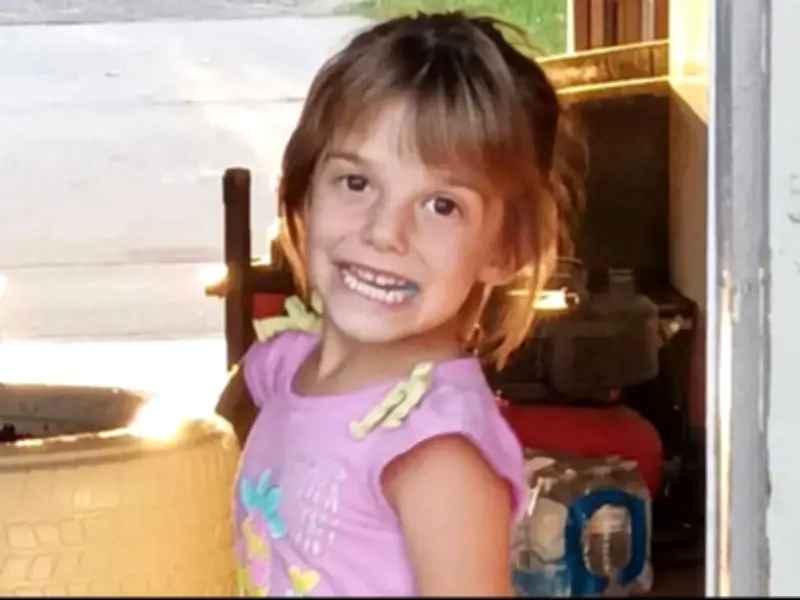 7-Year-Old Girl Scalp Ripped Off in Dog Attack, Family Speaks Out