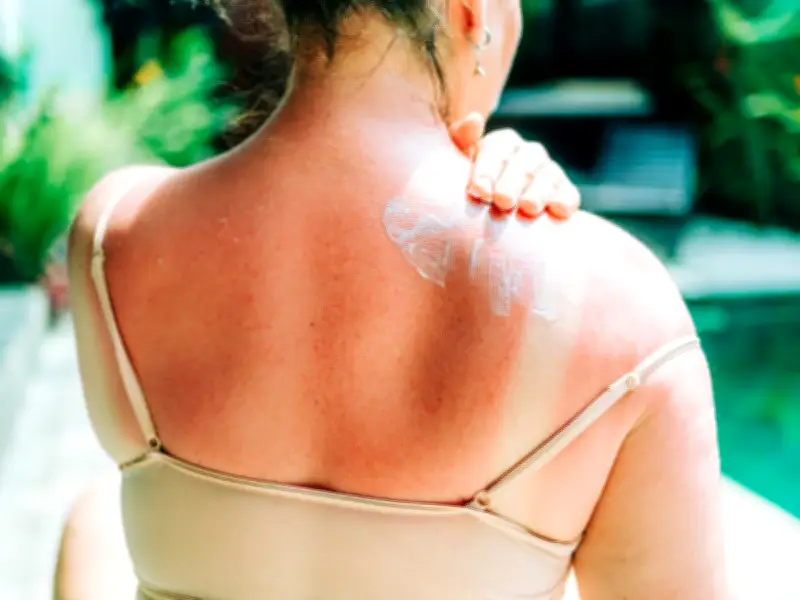 76% of Brits Use Sun Cream Abroad but Skip SPF at Home, Study Finds