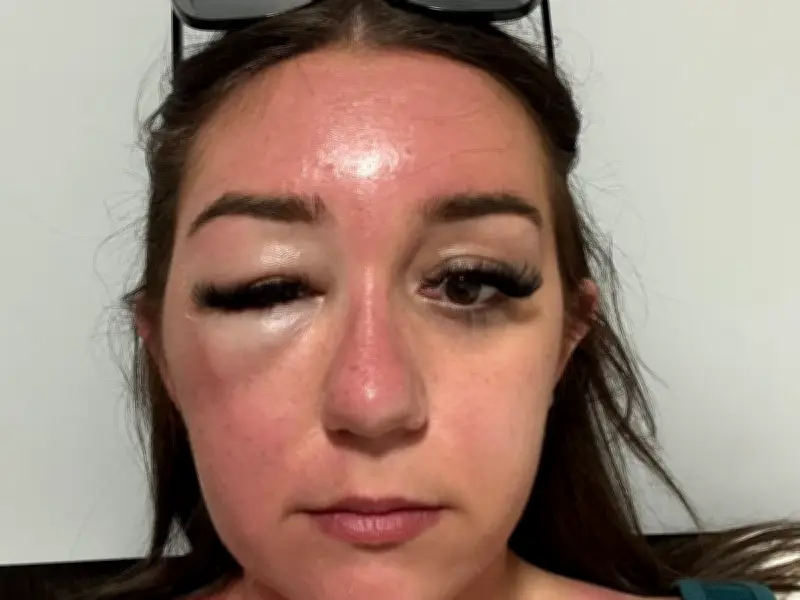 Brit Holidaymaker's 'Eye Bags' Lead to Mystery Illness Trapping Her in Greek Hospital for 9 Days