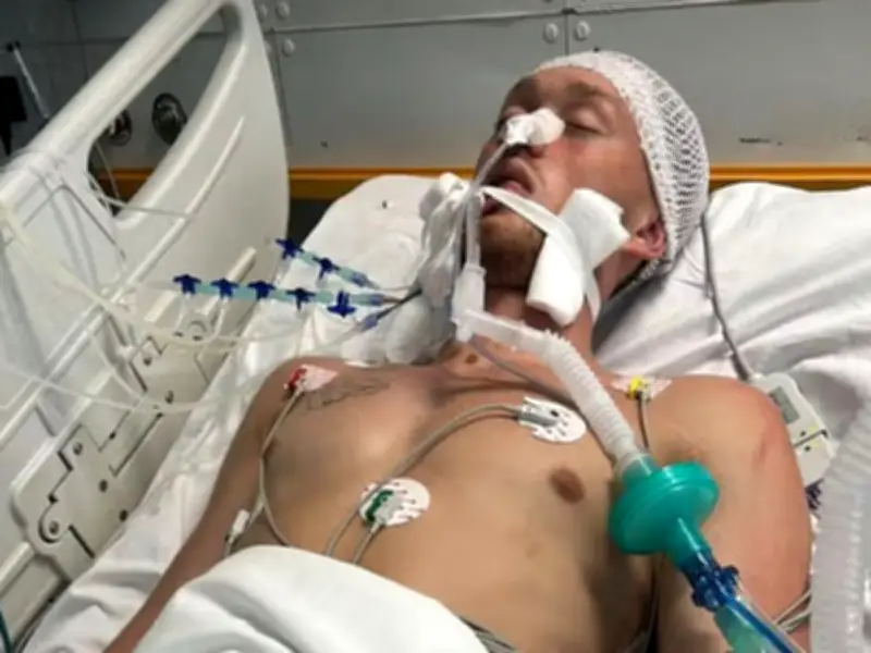 Brit Man, 20, in Coma After Zante Quad Bike Crash with Coach