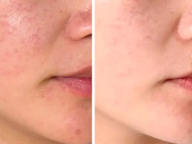 Dr Sam's New Moisturiser Gets Rave Reviews: 'Better Than 5-Year Fave'