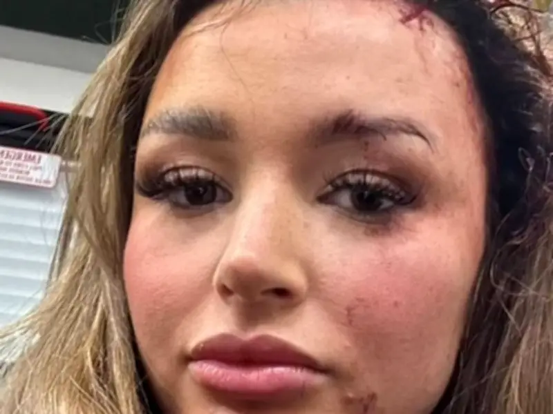 Love Island's Charleen Murphy Reveals Terrifying Attack Before Show