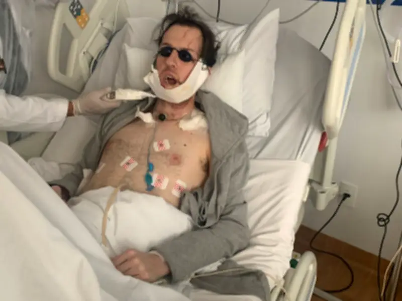 Man Has Jaw Rebuilt Using Leg Bone After Phone Thief Chase Fall