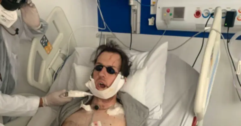 Man's Jaw Rebuilt with Leg Bone After Fall Chasing Thief