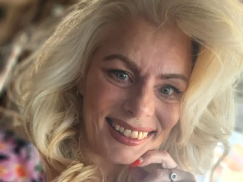 Mum's desperate fundraising for new teeth after mistaken identity attack