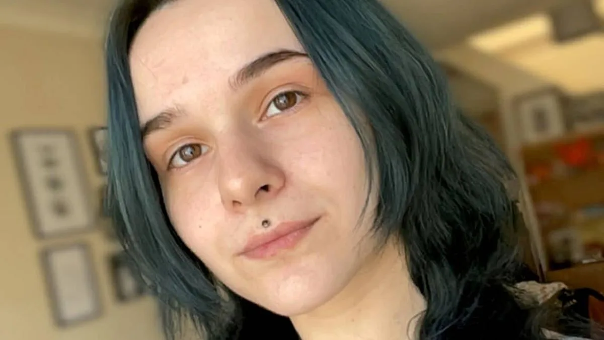 Woman Forced to Wear Baggy T-Shirts Due to Rare Sweating Condition