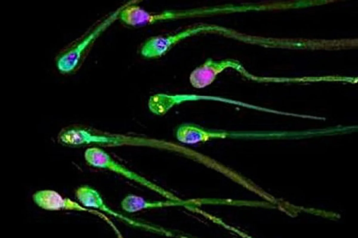 Sperm Has a Use-By Date: New Research Reveals How Abstinence Harms Male Fertility