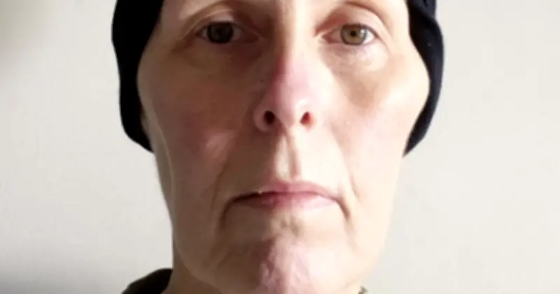Woman Mistook Leukaemia Symptoms for Menopause, Rushed to Hospital