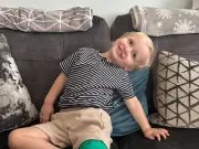 Hull Toddler with Rare Bone Condition Spent a Year with Broken Leg
