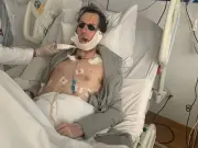 Man Has Jaw Rebuilt Using Leg Bone After Phone Thief Chase Fall